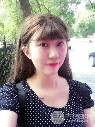 深圳臻希美詳細(xì)部自體脂肪填充果對(duì)比超明X