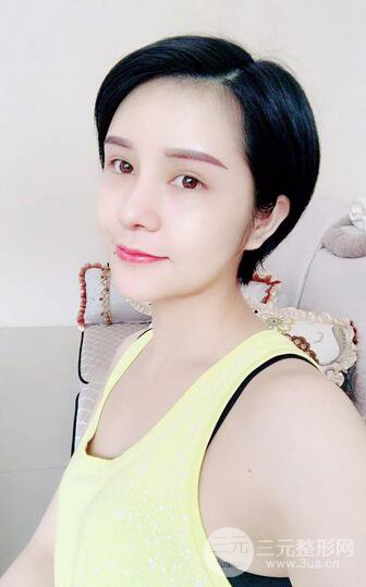 做了隆鼻整形隆鼻之后，短發(fā)女孩也可以性感！