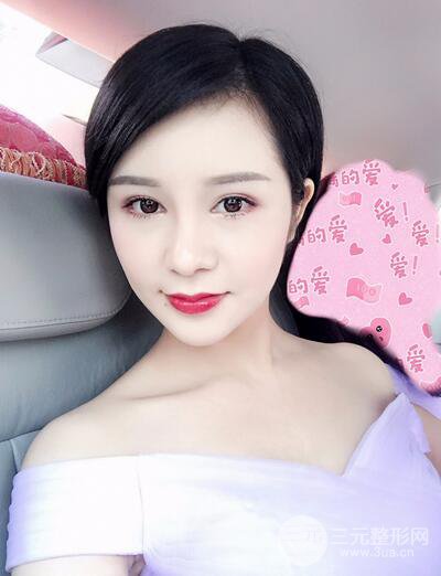 做了隆鼻整形隆鼻之后，短發(fā)女孩也可以性感！