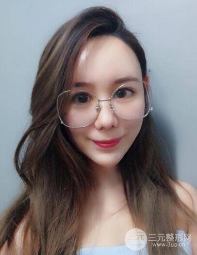 全臉自體脂肪填充，填充不飽滿還可以瘦臉_真人案例