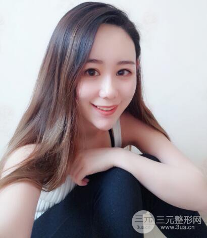 全臉自體脂肪填充，填充不飽滿還可以瘦臉_真人案例