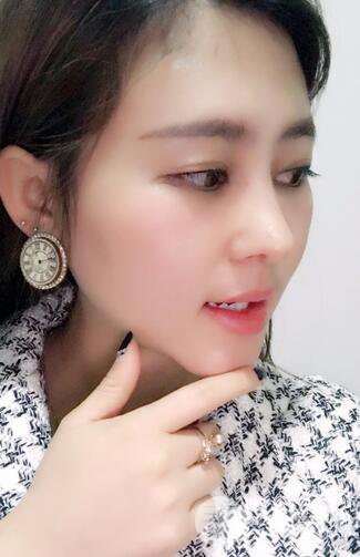 膨體隆鼻術(shù)后恢復(fù)果圖_全過程解密