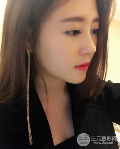 膨體隆鼻術(shù)后恢復(fù)果圖_全過程解密