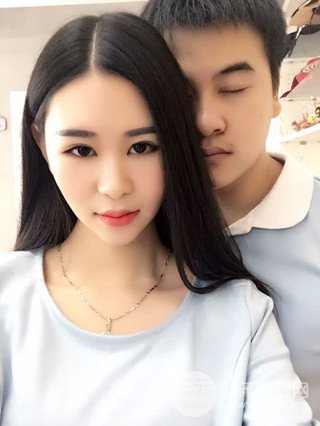 深圳全切雙眼皮修復(fù)成功案例恢復(fù)過程分享