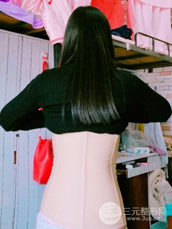 濟(jì)南腰腹吸脂案例三個(gè)月前后變化圖片分享