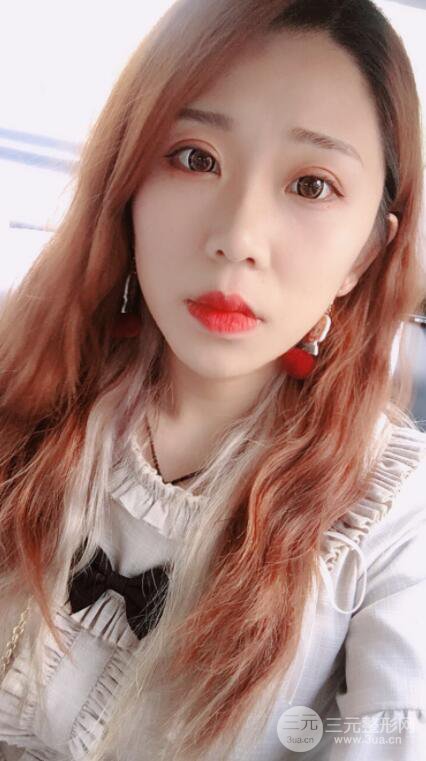 無(wú)錫菲尚徐火旺雙眼皮案例