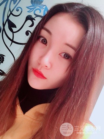 濟(jì)南硅膠假體墊下巴真人案例、下巴改變整個(gè)臉型