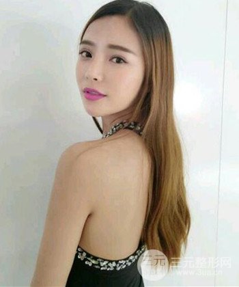 模特做隆鼻整形真實日記分享，附上恢復過程圖