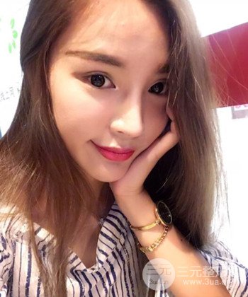 模特做隆鼻整形真實日記分享，附上恢復過程圖