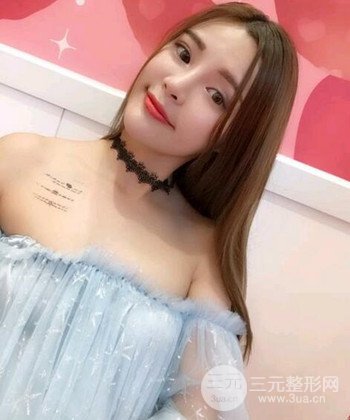 模特做隆鼻整形真實日記分享，附上恢復過程圖