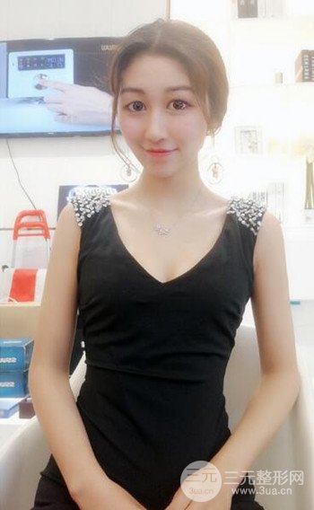 廣州隆鼻整形真實恢復期圖片，擁有精致美鼻不是夢