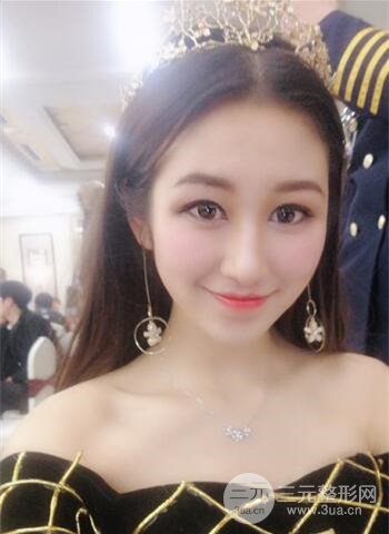 廣州隆鼻整形真實恢復期圖片，擁有精致美鼻不是夢