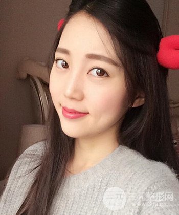 深圳內(nèi)切去眼袋+硅膠墊下巴真實(shí)案例恢復(fù)果圖