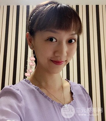 北京雙眼皮失敗修復(fù)手術(shù)日記分享，附上前后對(duì)比照片