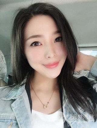 面部吸脂瘦臉手術(shù)日記分享,瘦臉果驚人