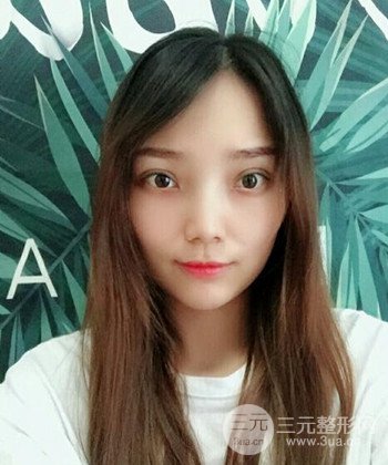 雙眼皮失敗修復(fù)手術(shù)日記分享，改變雙眼皮不對(duì)稱