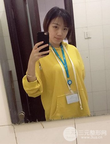 北京內(nèi)切祛眼袋真人案例果對比分享，年輕十歲不是夢