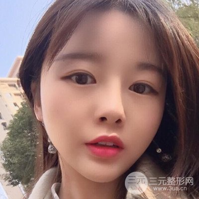 做了牙齒冷光美白果很棒,綻放美麗笑容