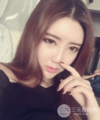 全臉自體脂肪填充手術(shù)日記分享，改良臉型年輕十歲