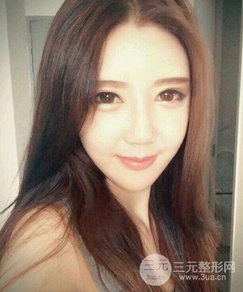 全臉自體脂肪填充手術(shù)日記分享，改良臉型年輕十歲