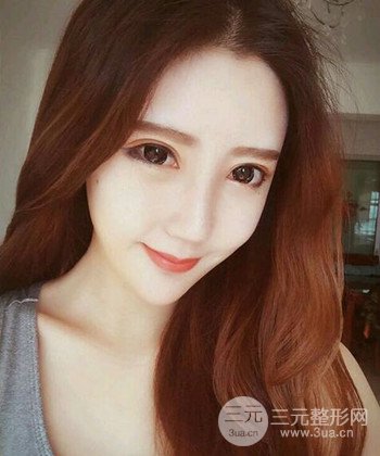 全臉自體脂肪填充手術(shù)日記分享，改良臉型年輕十歲