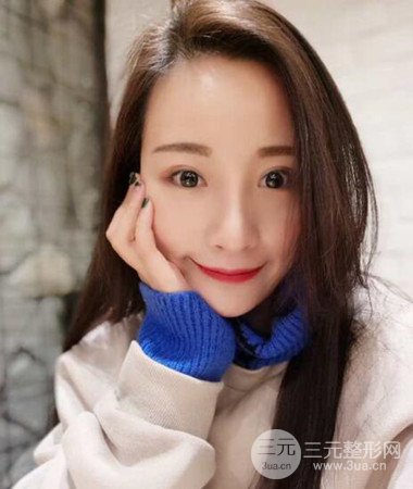 內(nèi)切微創(chuàng)去眼袋手術(shù)案例分享，附上手術(shù)恢復(fù)照片