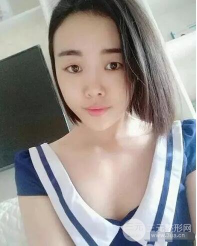 成都玉之光自體脂肪面部填充劉中國真人案例反饋|內(nèi)附對比前后照