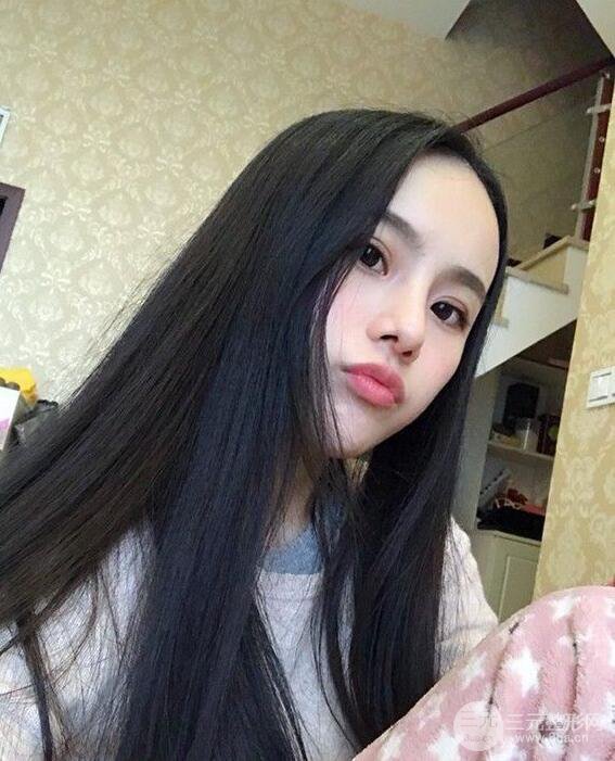 成都大華隆鼻怎么樣?真實案例前后對比圖記錄恢復過程