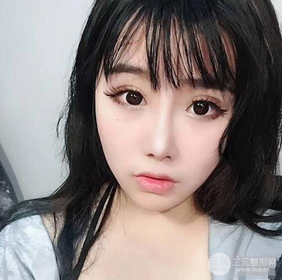 合肥壹加壹甘泉涌軟骨隆鼻前后對比圖|內(nèi)附真人案例恢復(fù)前過程