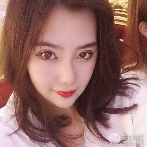 合肥壹加壹甘泉涌軟骨隆鼻前后對比圖|內(nèi)附真人案例恢復(fù)前過程