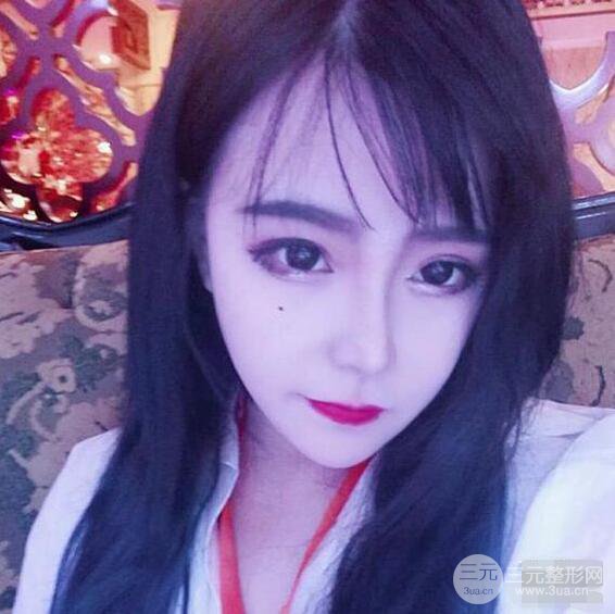 合肥壹加壹甘泉涌軟骨隆鼻前后對比圖|內(nèi)附真人案例恢復(fù)前過程