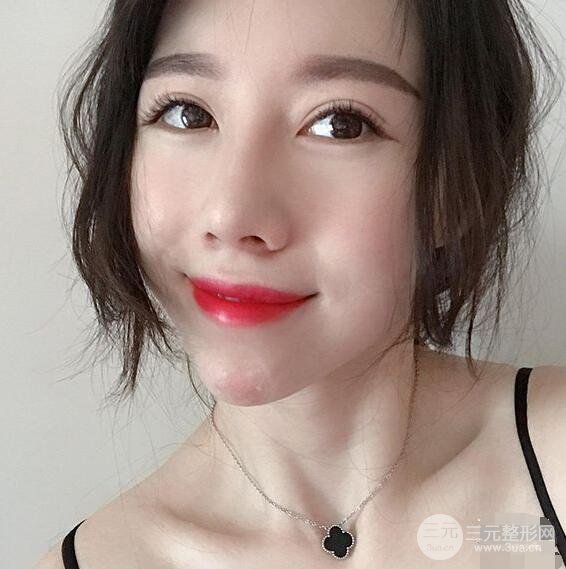 北京聯(lián)合麗格吳焱秋耳軟骨隆鼻前后對比圖|塌鼻子的救星