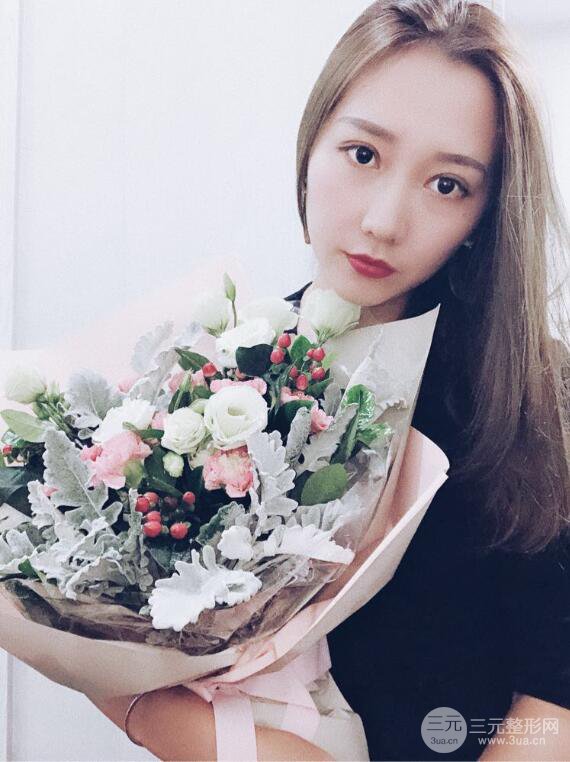 哈醫(yī)大二院整形科肖志波全切雙眼皮前后對比圖 真實恢復(fù)經(jīng)歷日記