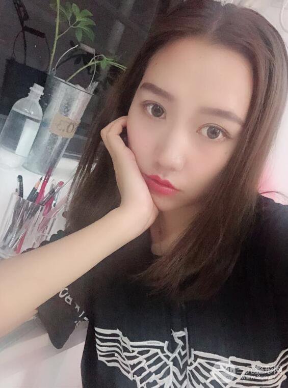 哈醫(yī)大二院整形科肖志波全切雙眼皮前后對比圖 真實恢復(fù)經(jīng)歷日記