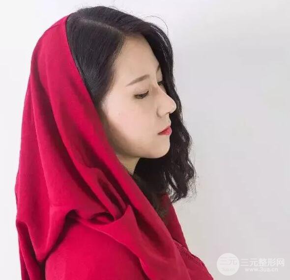 北京藝星仇侃敏微創(chuàng)肋軟骨隆鼻前后對比圖 術后一個月的恢復狀況