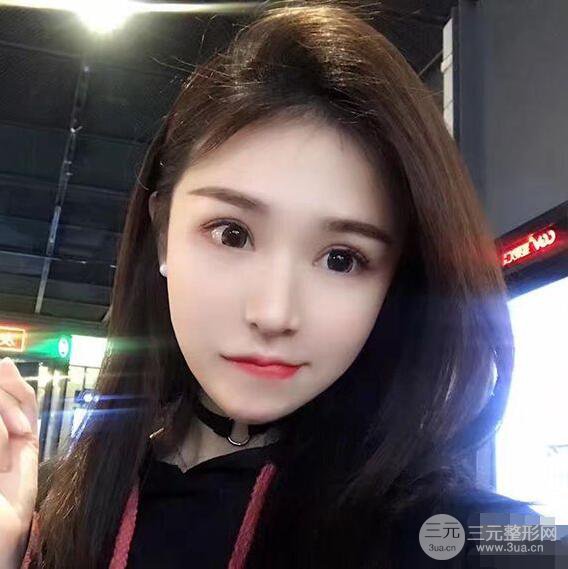 延吉金光善眼部整形失敗修復(fù)前后對比圖 三個月恢復(fù)自然