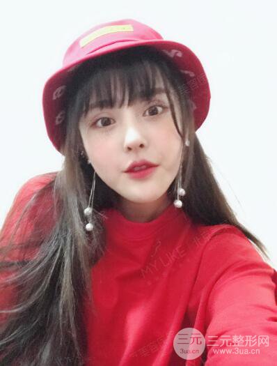 北京美萊趙峻賢隆鼻整形真實案例對比圖恢復(fù)過程分享