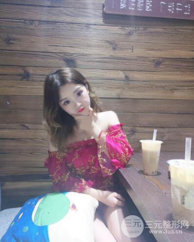 成都天使之翼張勁松切開雙眼皮案例前后對比圖心情小札