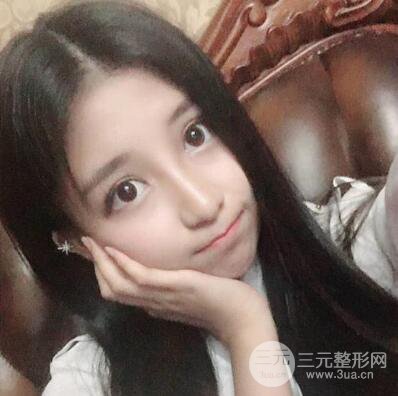 沈陽(yáng)軍區(qū)總醫(yī)院時(shí)杰切開(kāi)雙眼皮案例對(duì)比圖|內(nèi)附心情恢復(fù)小札哦