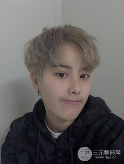 哈醫(yī)大二院整形科肖志波割雙眼皮對(duì)比圖男性案例