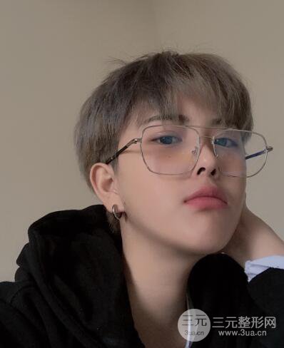 哈醫(yī)大二院整形科肖志波割雙眼皮對(duì)比圖男性案例