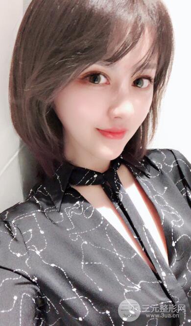 常州施爾美廉鋒自體脂肪豐臉對(duì)照?qǐng)D案例心情日扎