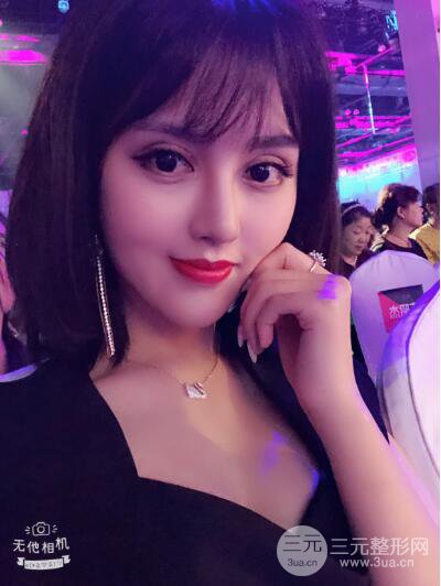 常州施爾美廉鋒自體脂肪豐臉對(duì)照?qǐng)D案例心情日扎