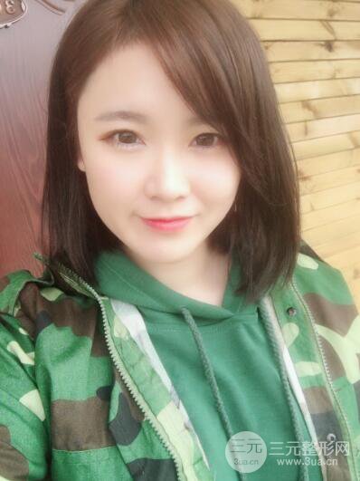 貴陽美萊梁潔芭比媚雙眼皮多項整形前后對比圖恢復(fù)心情小札