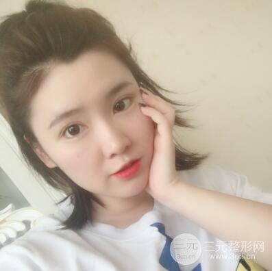 貴陽美萊梁潔芭比媚雙眼皮多項整形前后對比圖恢復(fù)心情小札