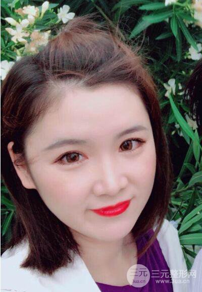 貴陽美萊梁潔芭比媚雙眼皮多項整形前后對比圖恢復(fù)心情小札