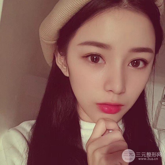 【隆鼻整形+進(jìn)口假體+耳軟骨墊鼻尖+鼻頭鼻翼縮小+鼻尖延長】綜合改良！