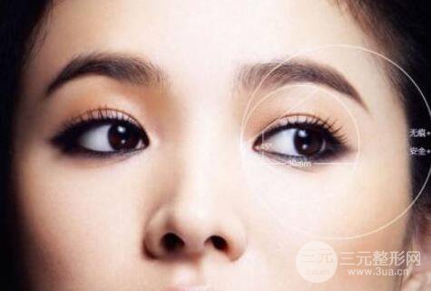 成都全切雙眼皮果?全切雙眼皮果怎么樣?