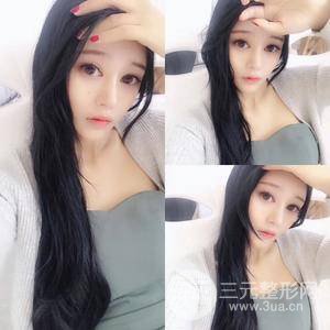 自體細(xì)胞注射