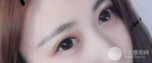 術(shù)后注意事項(xiàng)